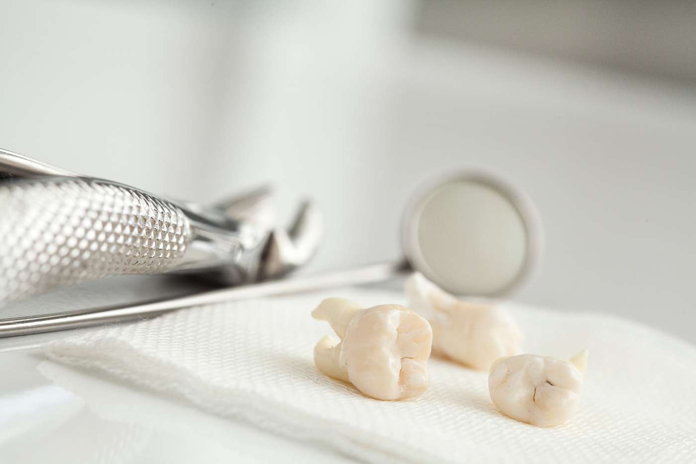 Fa male l'estrazione di un dente?