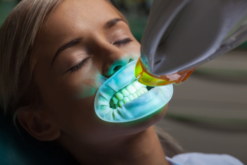 Sbiancamento denti